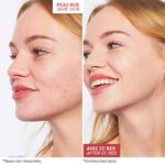 CC Red Correct - Anti redness cream cc red correct anti redness cream